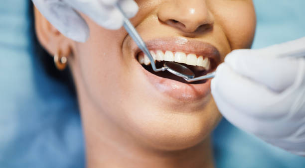 Best Emergency Wisdom Teeth Removal in Dayton, WA